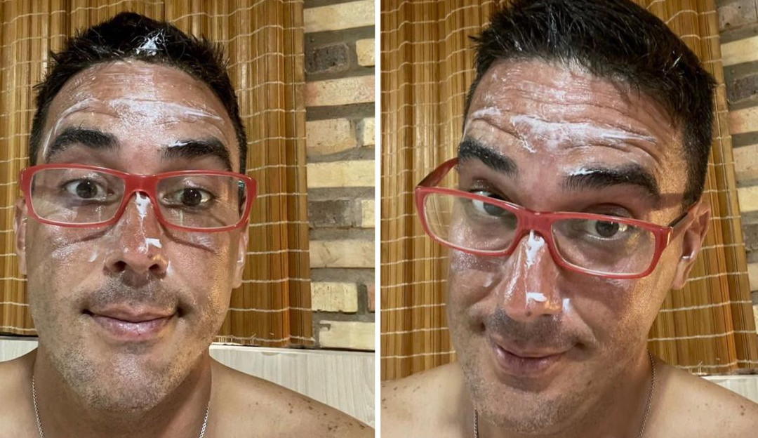 André Marques publica foto com o rosto queimado de sol devido as gravações do ‘No Limite’