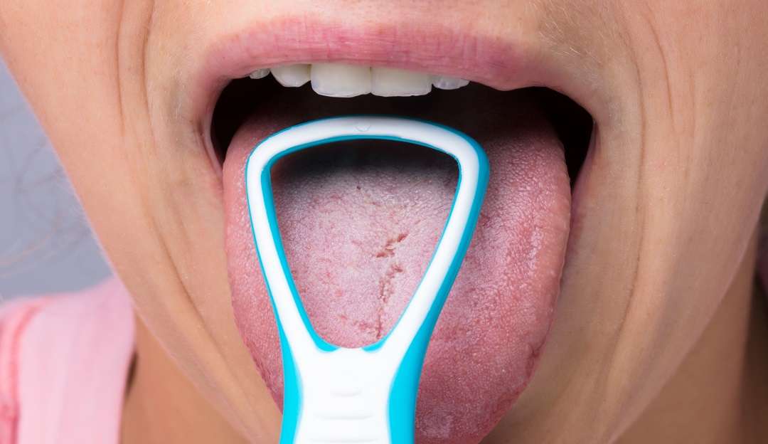 Saburra lingual: Saiba os sintomas, causas e tratamento