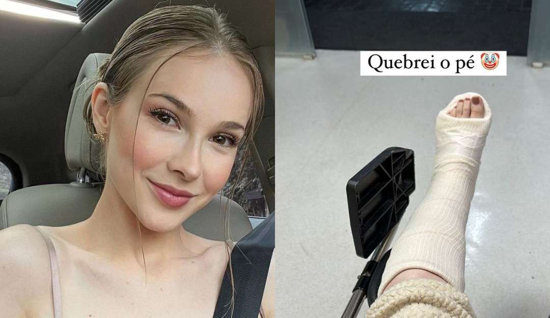 Sammy aparece com pé quebrado após acidente doméstico