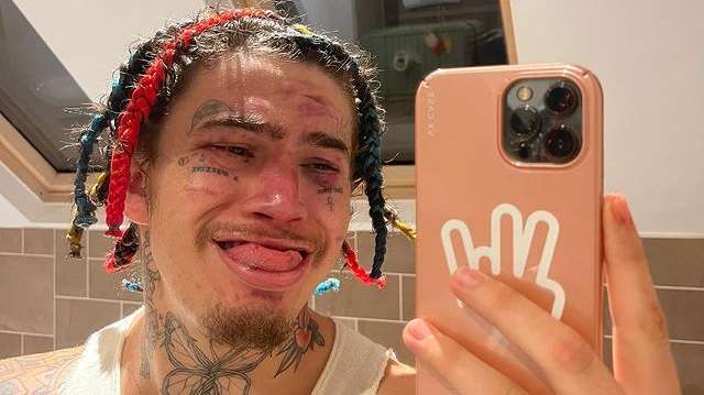 Whindersson Nunes brinca após derrota no boxe: “Aprende, Filipek”