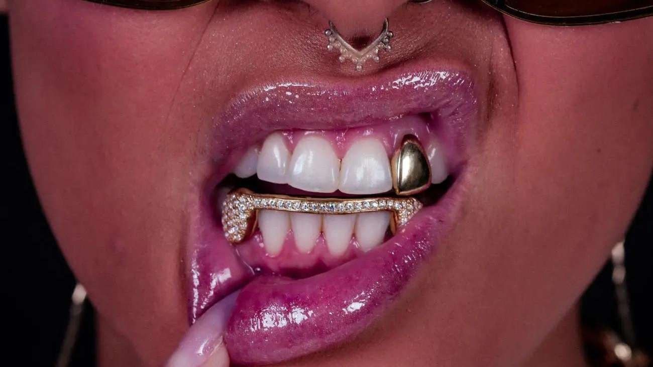Grillz nos dentes: tendência que não sai da boca