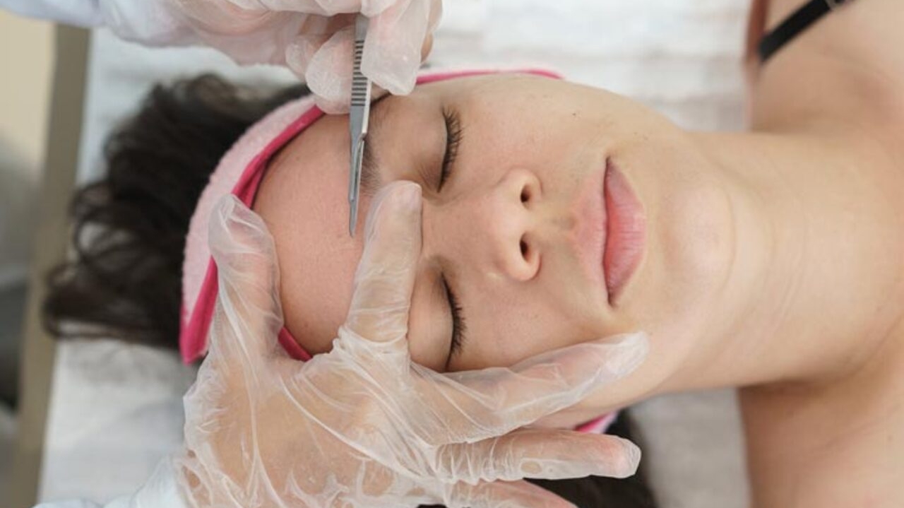Dermaplaning: conheça a técnica para uma pele jovem e radiante