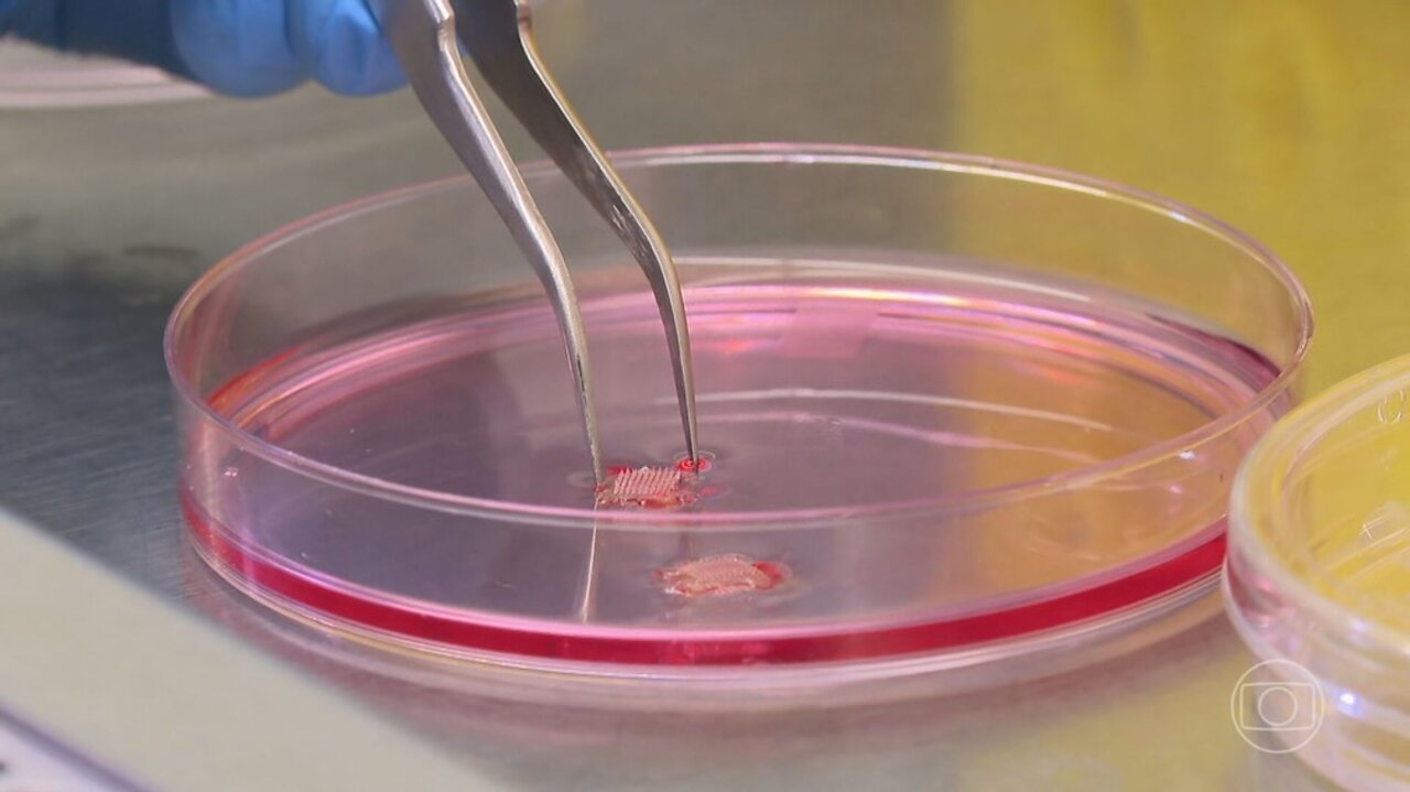 Adesivo que substitui picadas de agulhas é desenvolvido por universidades brasileiras