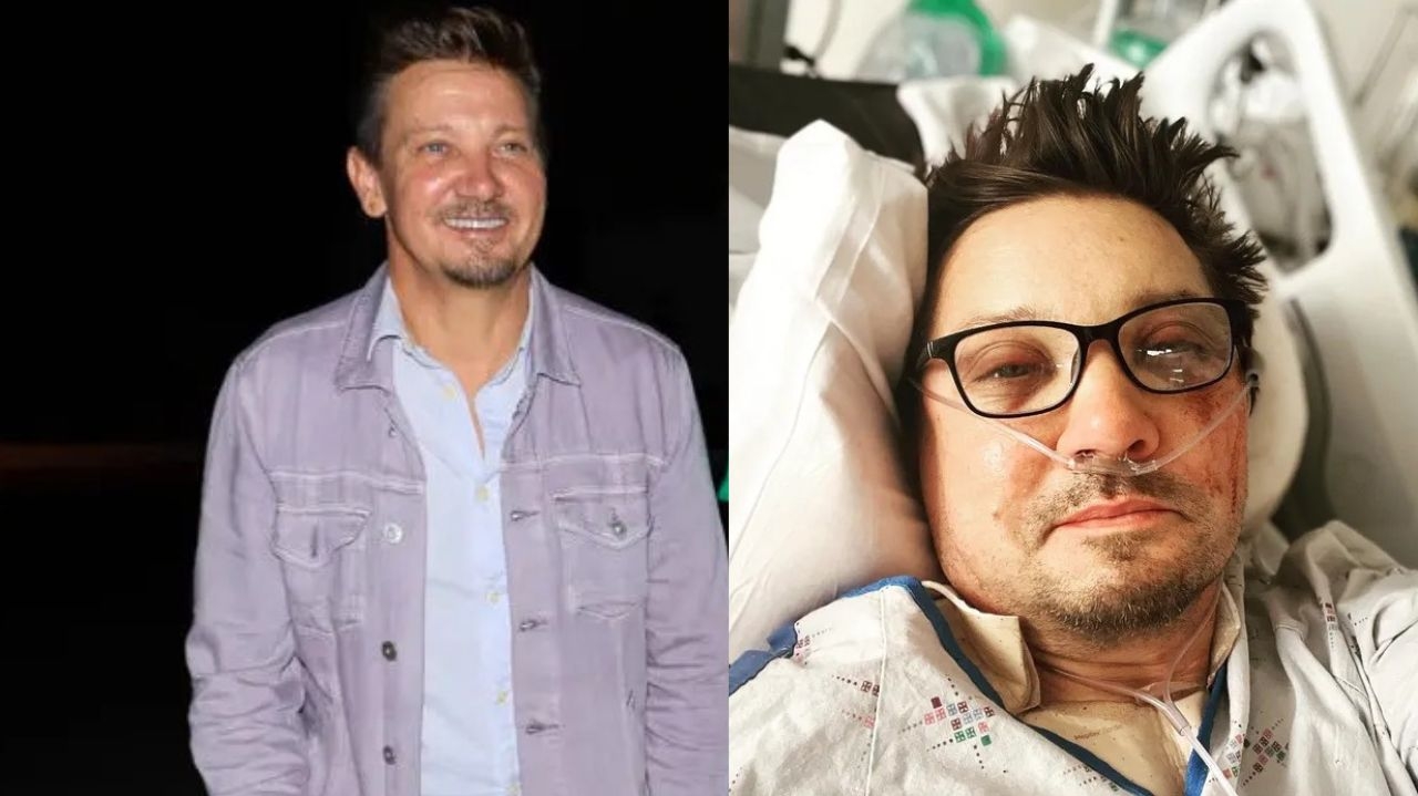 Jeremy Renner está totalmente recuperado após atropelamento que o fez quebrar 30 ossos