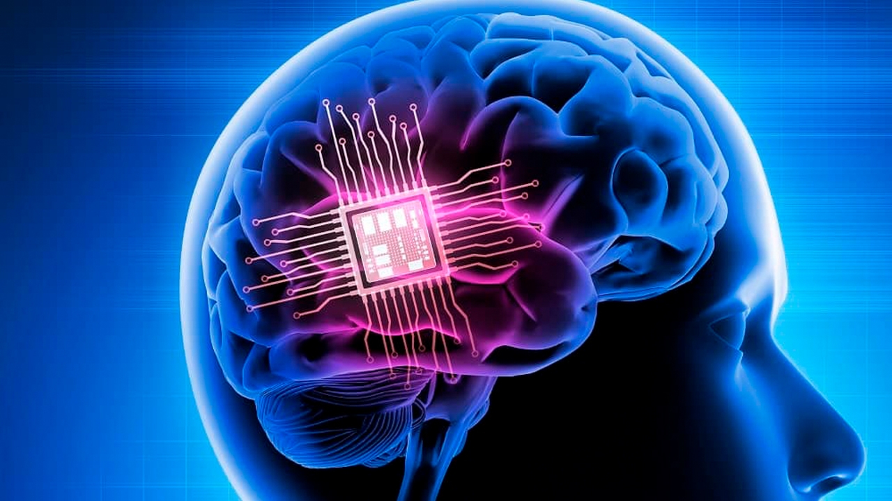 Avanços na tecnologia de implantes cerebrais podem devolver a fala para pessoas paralisadas