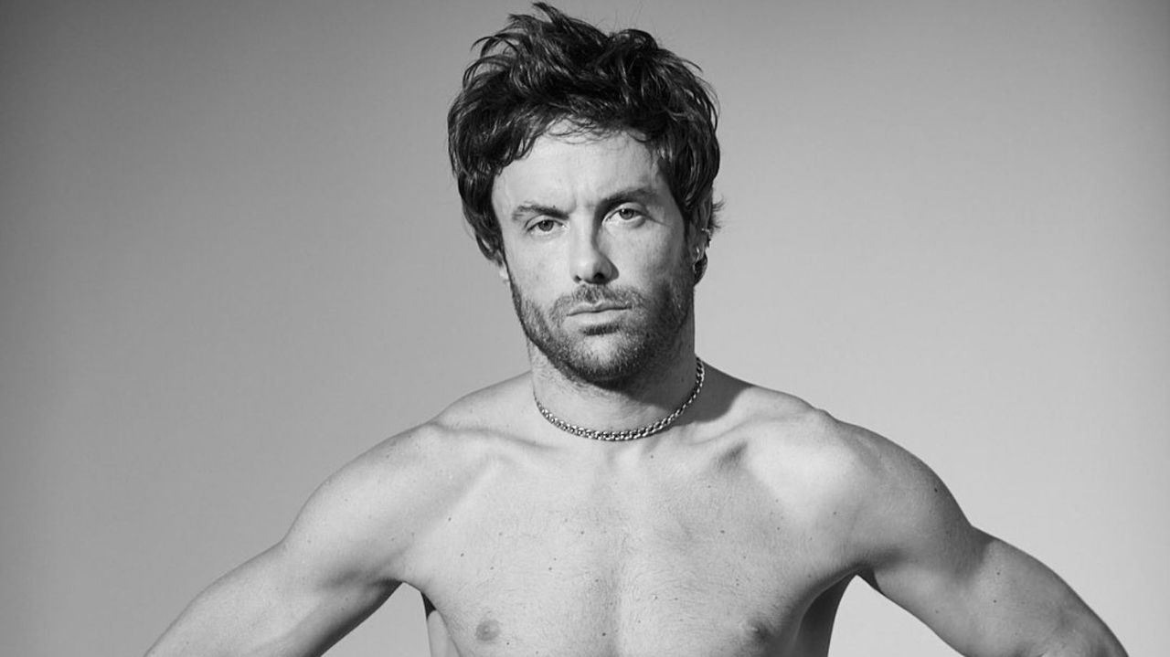 Ator Kayky Brito é atropelado no Rio de Janeiro e sofre traumatismo craniano