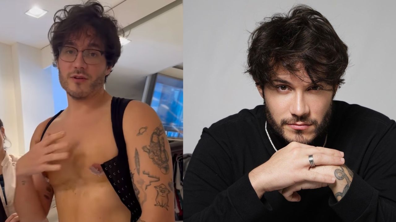 Eliezer mostra resultado de cirurgias para redução das mamas