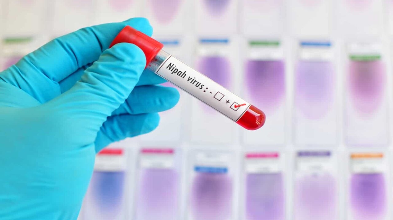 Estado da Índia decreta lockdown para combater vírus Nipah