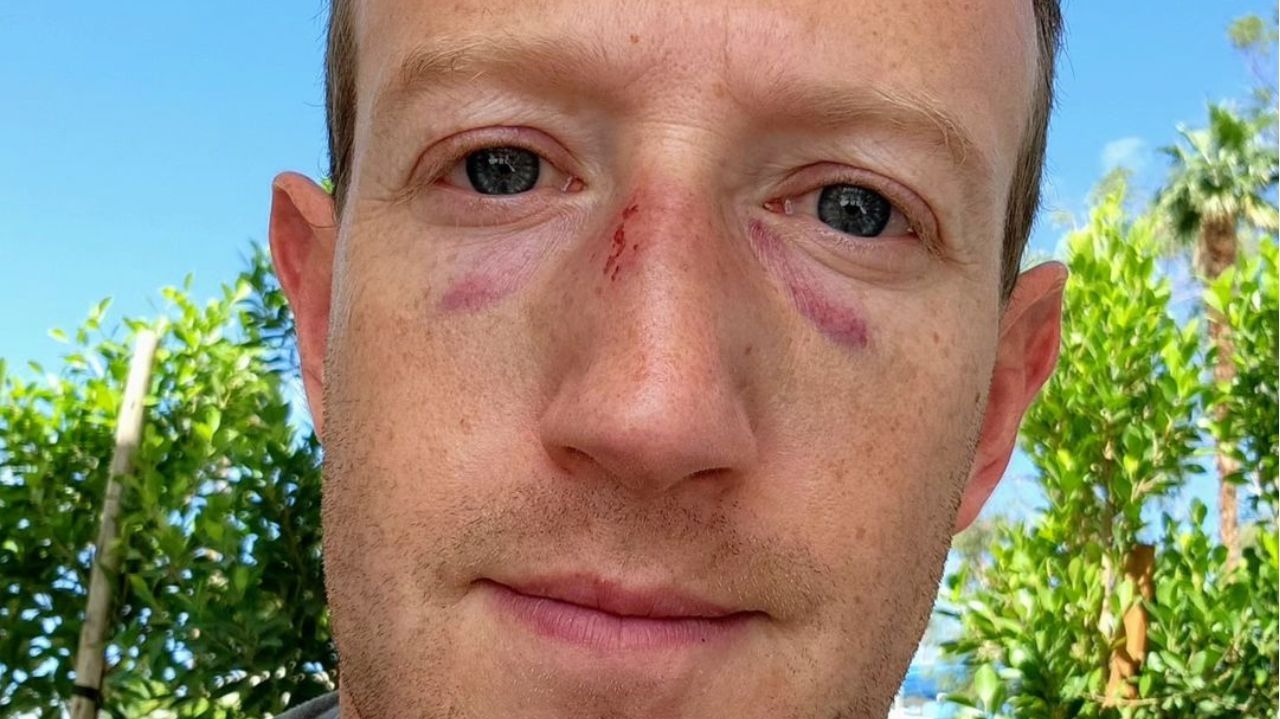 Mark Zuckerberg posta selfie com hematomas no rosto