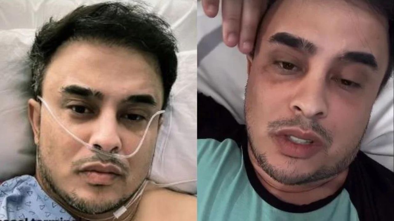 Kauan, da dupla com Matheus, passa por cirurgia de emergência