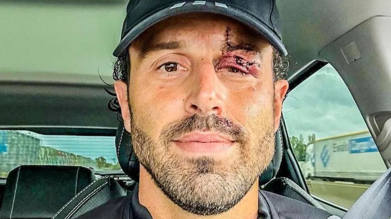 Fábio Grosso aparece com ferimento grave após ataque ao ônibus do Lyon