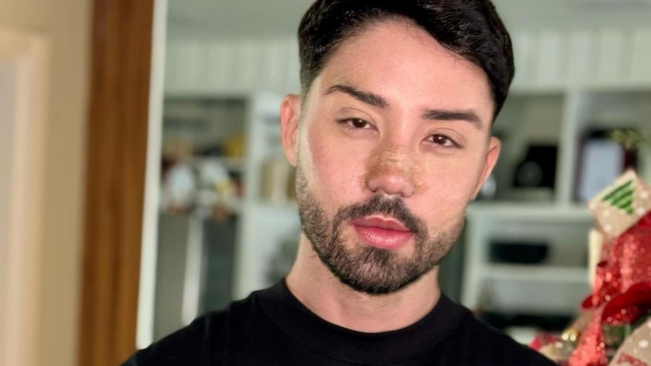 Rico Melquiades revela resultado de plástica no rosto nas redes sociais e recebe críticas