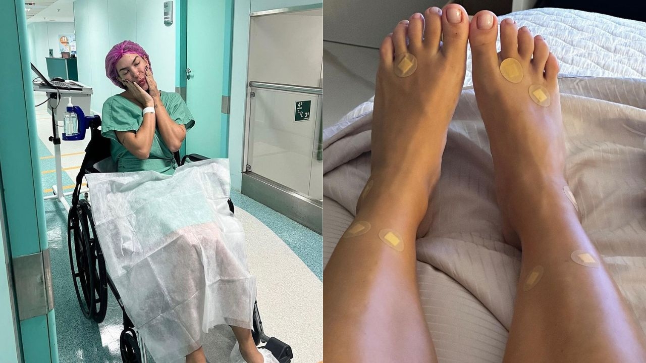 Lore Improta passa por cirurgia após problemas nos pés
