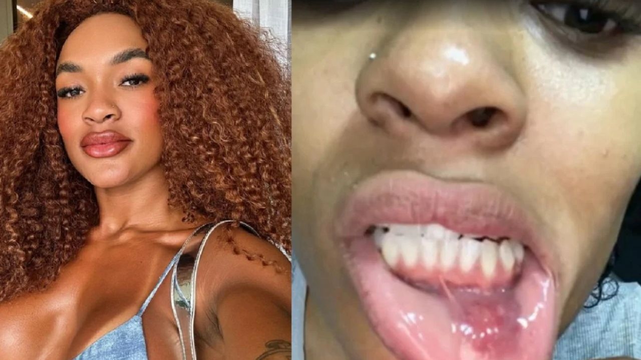 Patrícia Ramos expõe lesões sofridas durante episódios de violência doméstica