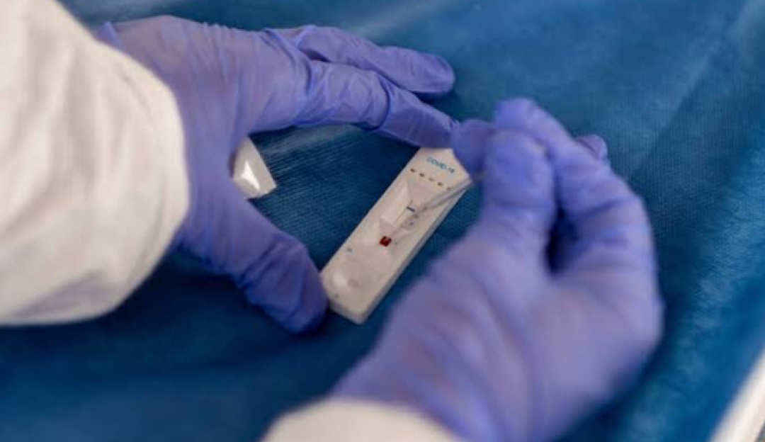 Coronavírus: UFPel retoma pesquisas sobre a Covid-19