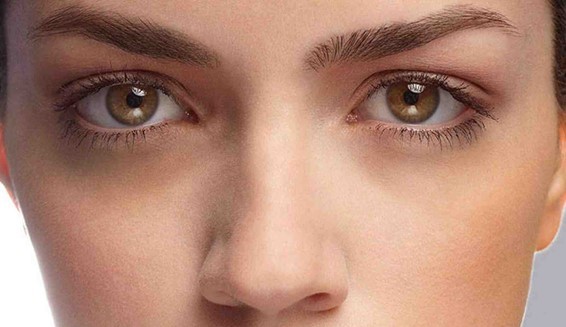 Olheiras: Qual o melhor tratamento?