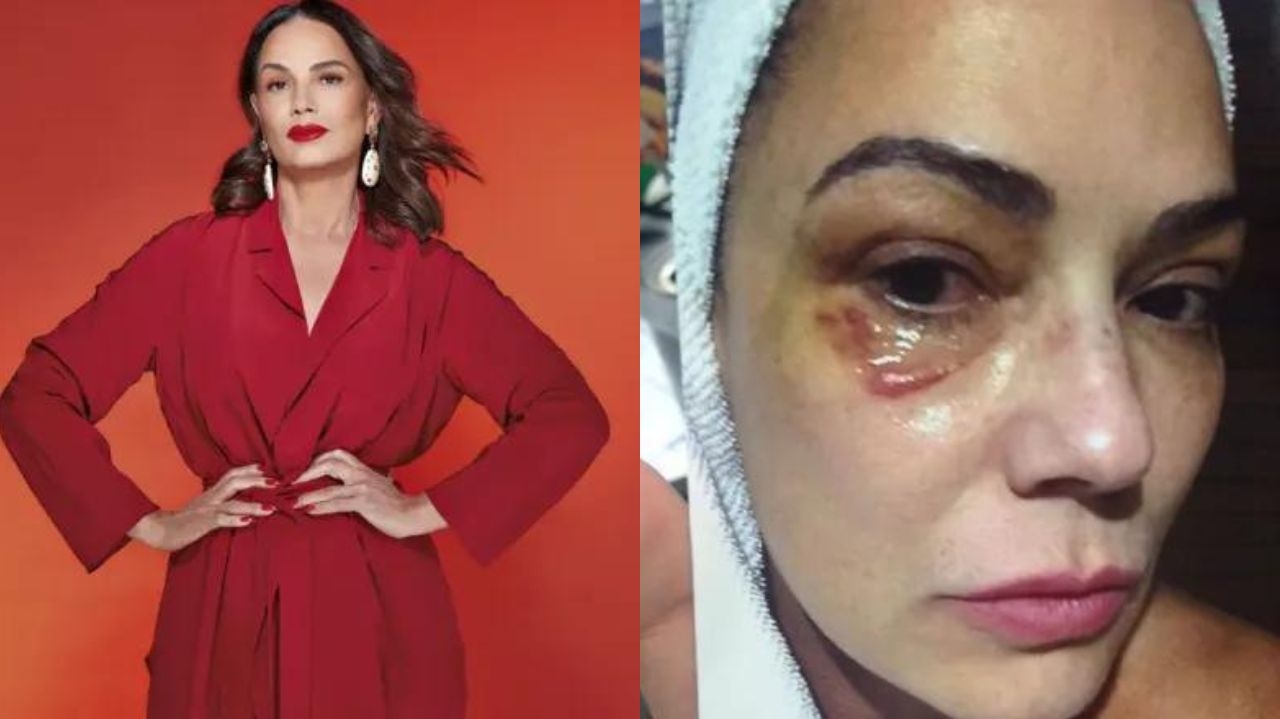 Luíza Brunet pede indenização milionária por agressão de ex-marido