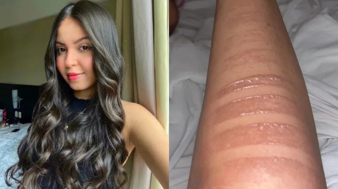 Fã sergipana sofre queimaduras ao aguardar show de Taylor Swift no RJ