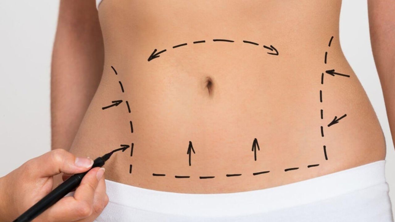 Saiba os cuidados para cirurgias plásticas no verão
