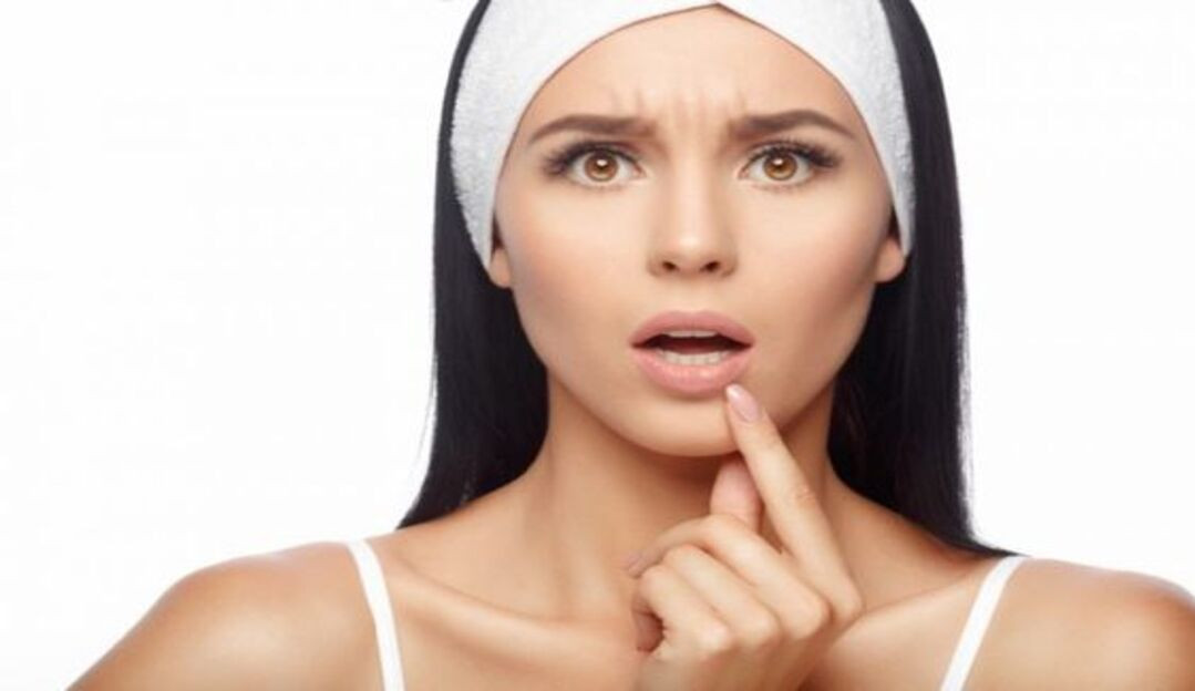 Três hidratantes baratinhos para manter seus lábios hidratados