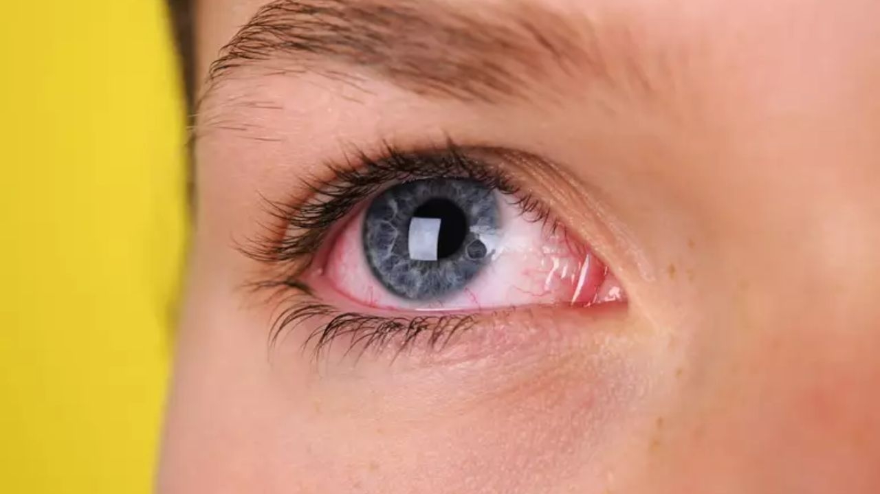 Cerca de 170 pessoas são atendidas após uso de pomadas capilares