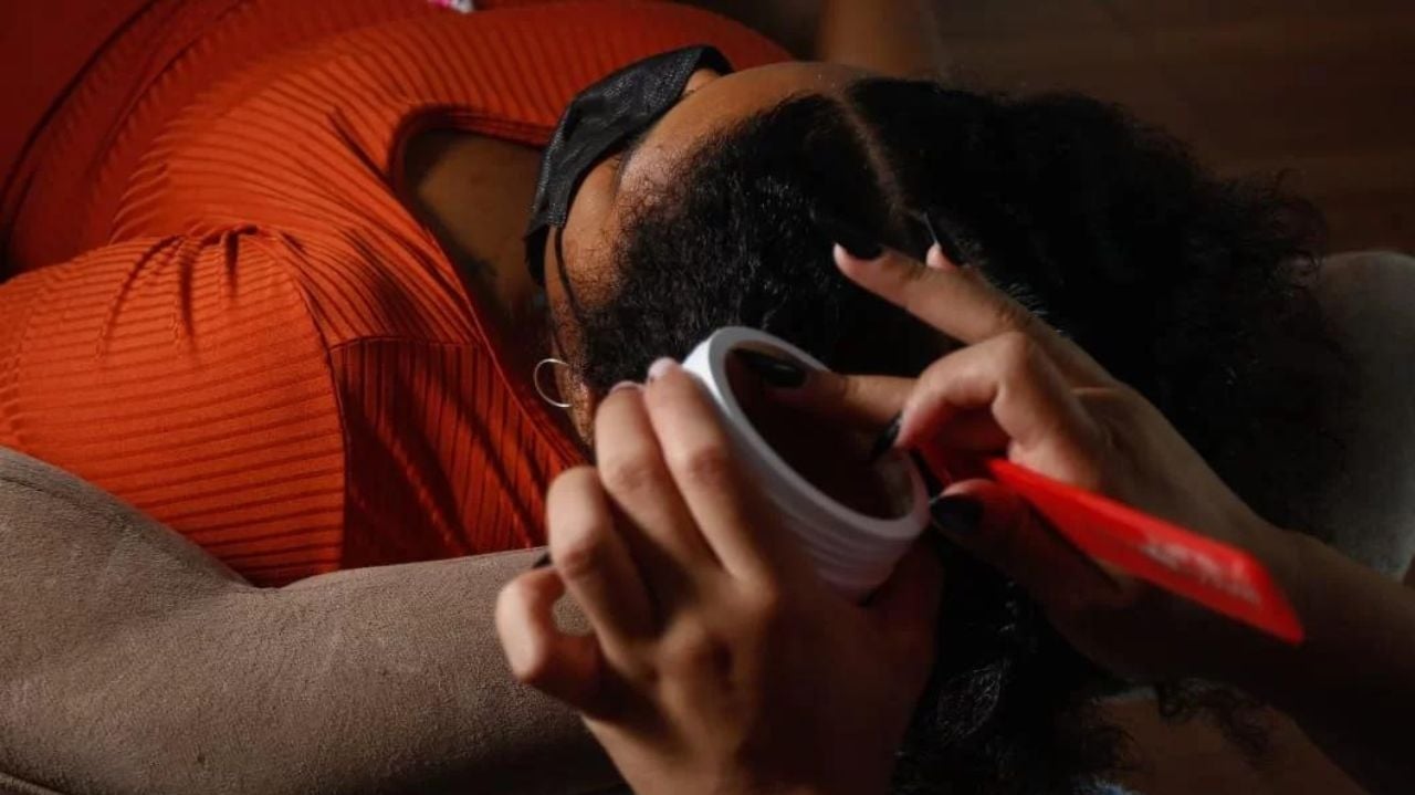 Anvisa cancela mais de mil pomadas capilares devido a riscos à saúde ocular