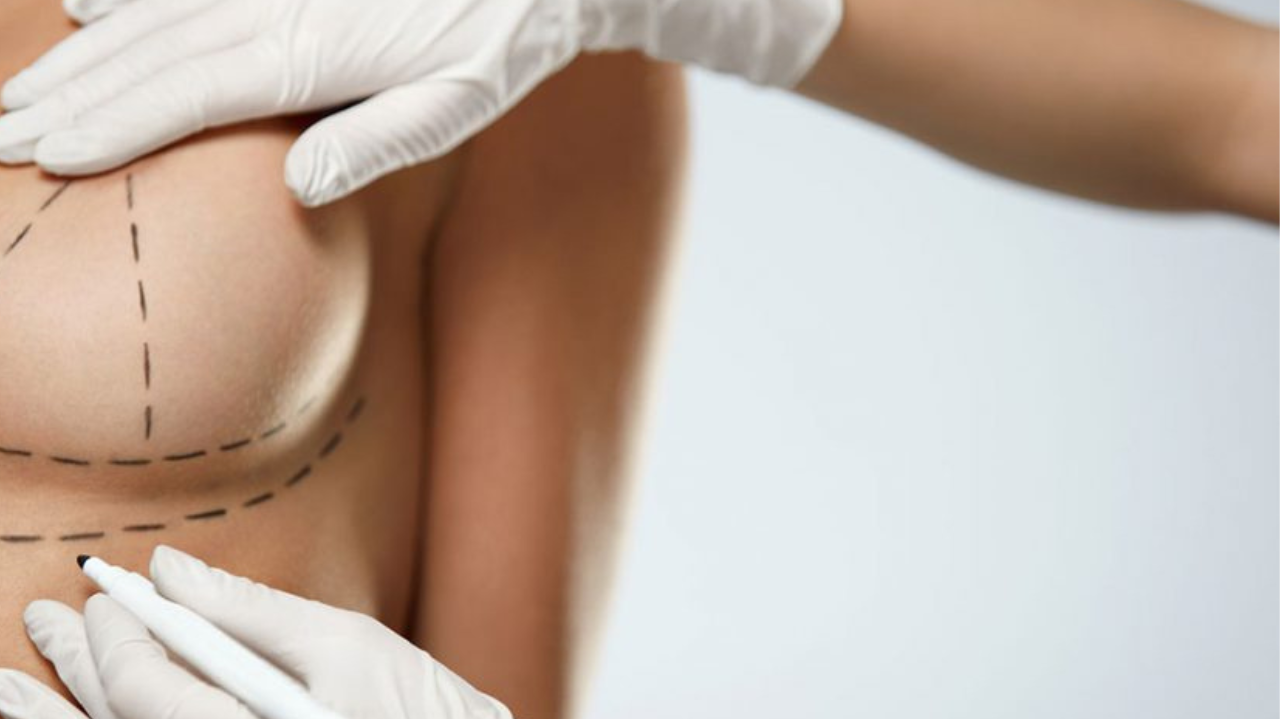 Conheça um guia completo para um procedimento estético de forma correta