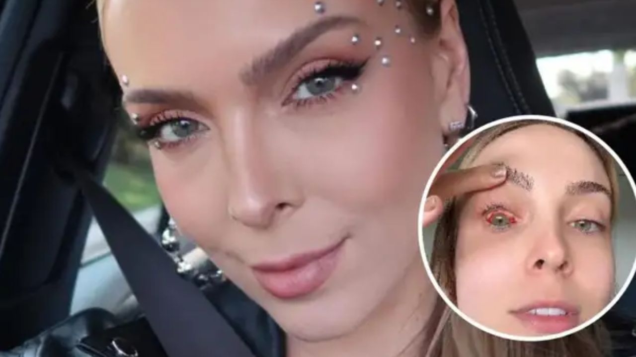 Tata Estaniecki explica sobre sua aparência após derrame ocular