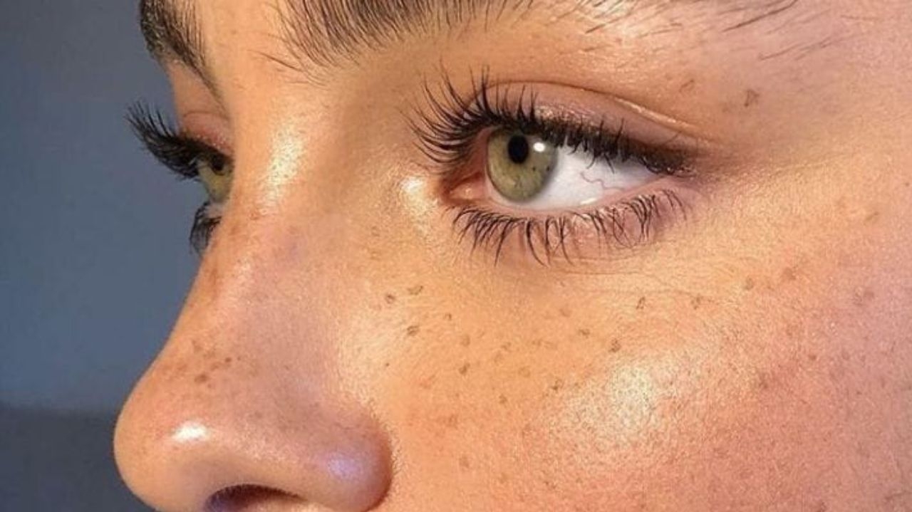 Sardas fake: especialistas alertam sobre os perigos de tatuá-las no rosto