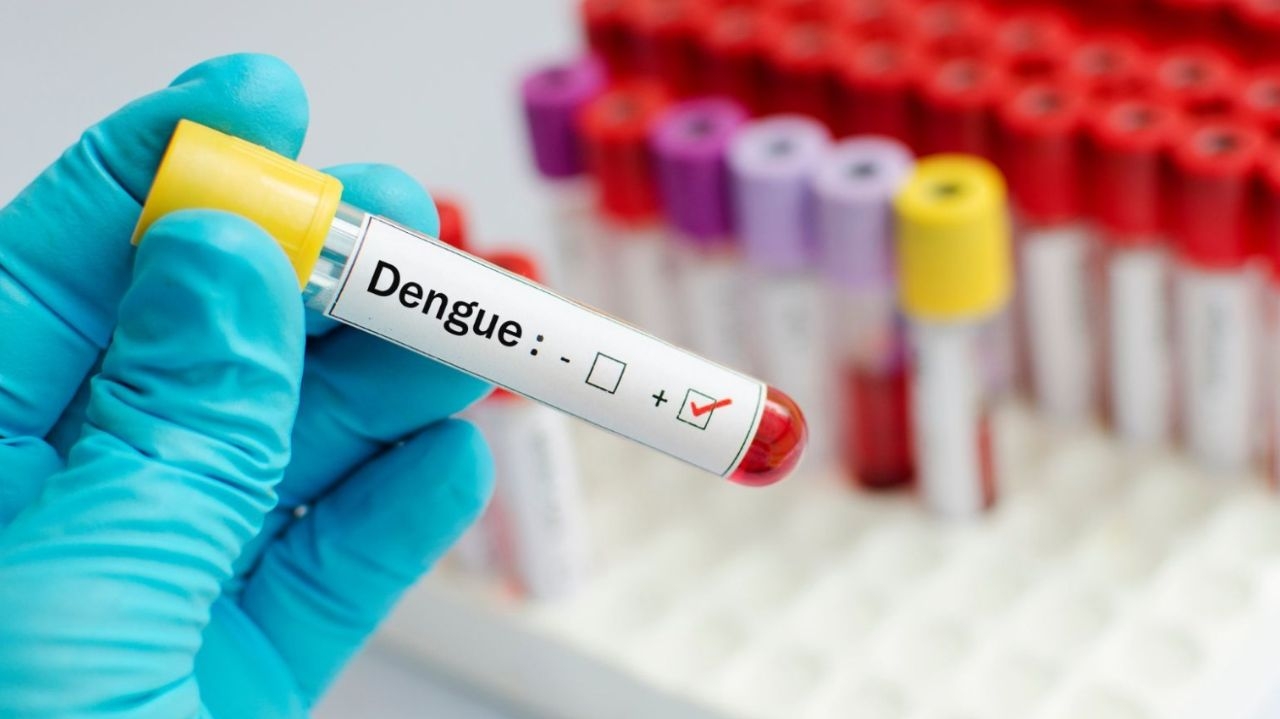 Aumento alarmante de mortes por Covid supera casos de dengue em São Paulo