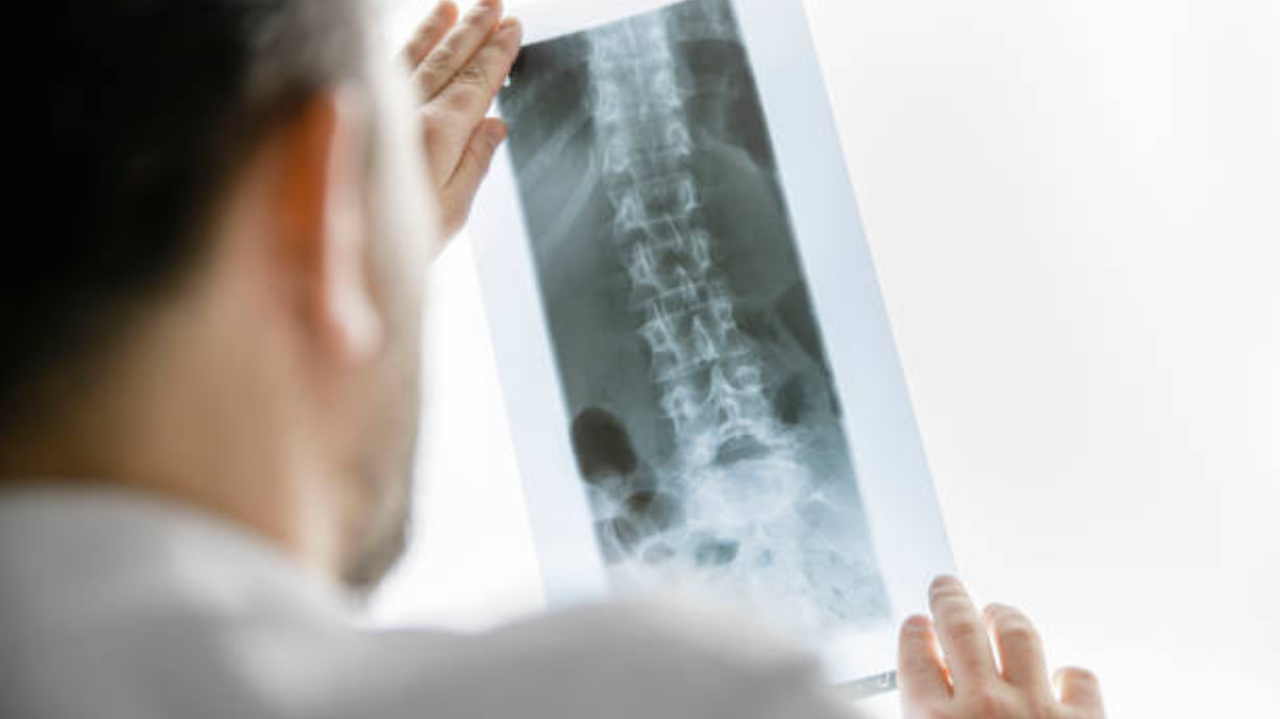 Dor na coluna: especialistas alertam para a importância da investigação