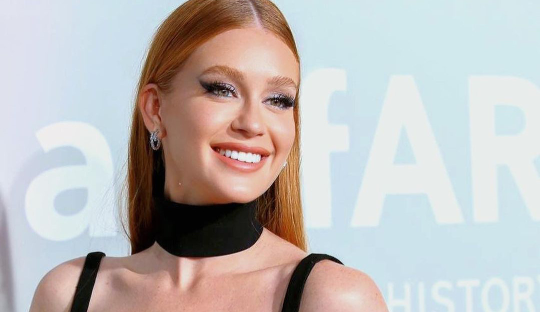 Marina Ruy Barbosa nega ter feito bichectomia