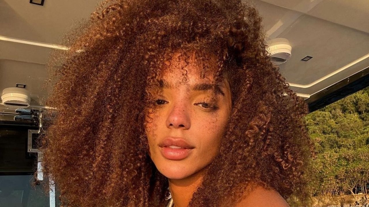 Brunna Gonçalves realiza a cirurgia de frontoplastia com avanço capilar