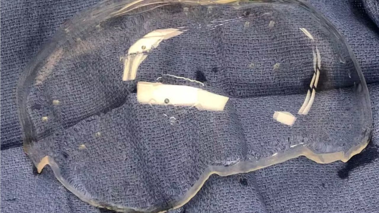 Implante transparente no crânio pode revolucionar estudos