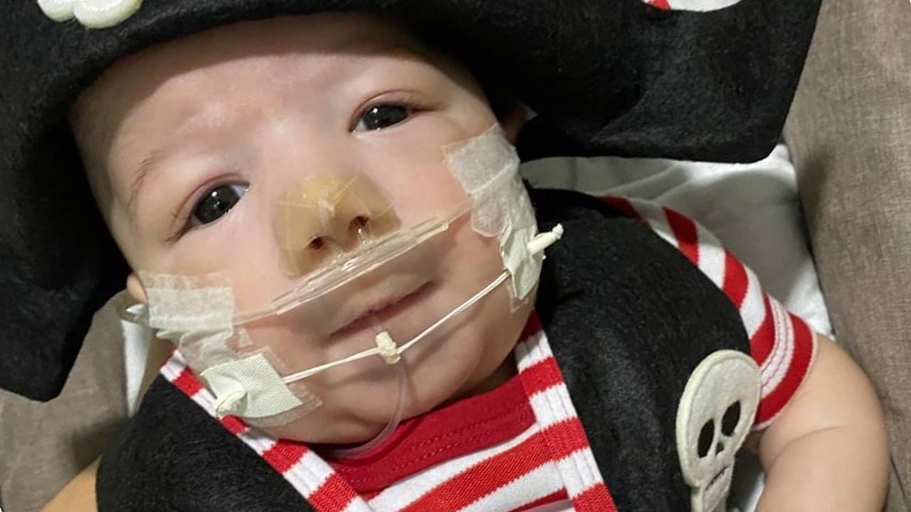 Síndrome de Patau: o que é a doença rara do filho de Zé Vaqueiro