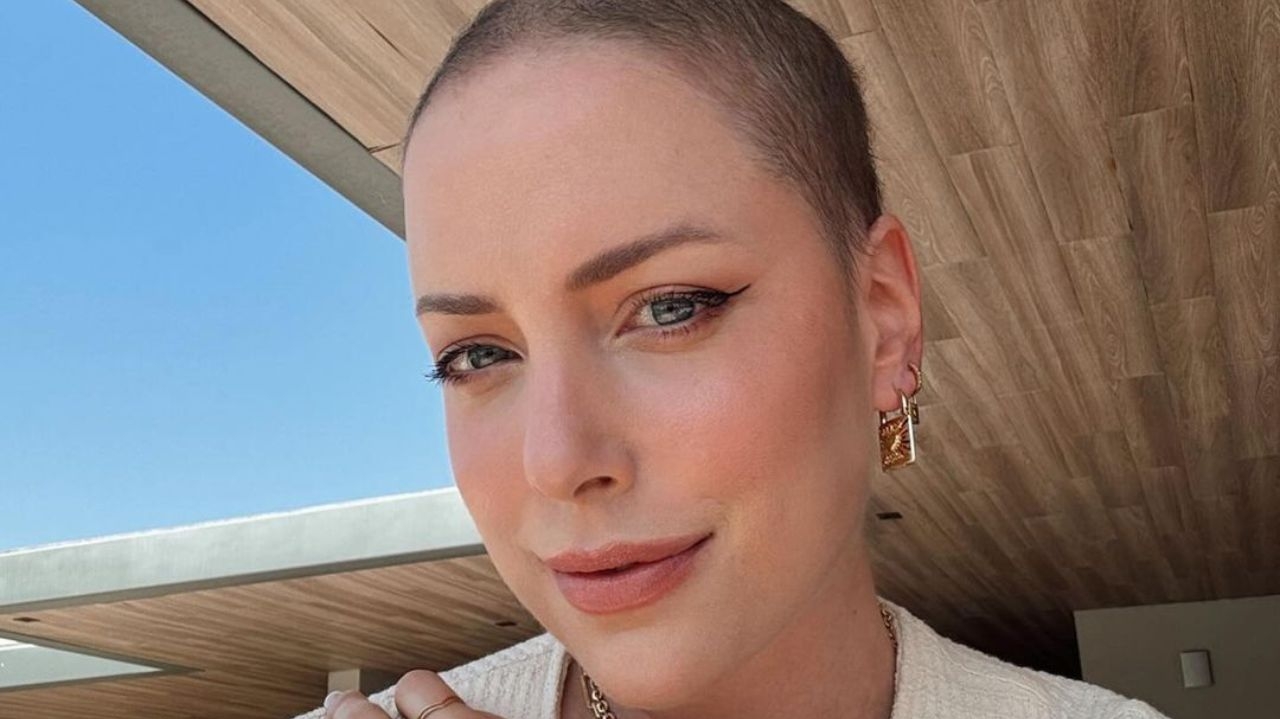 Fabiana Justus revela que passará por cirurgia para retirar nódulo benigno