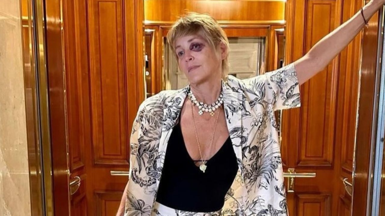 Sharon Stone reaparece e explica razão por trás do olho roxo
