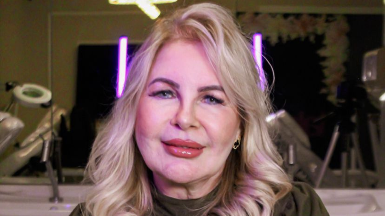 Preenchimento Labial: Dra. Elisabeth Almeida esclarece principais dúvidas sobre o tema