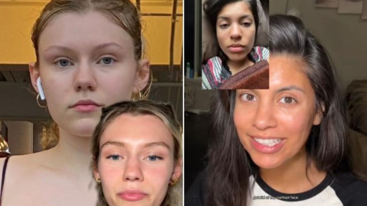 “Cortisol face”: trend aponta esse hormônio como responsável pelo inchaço facial