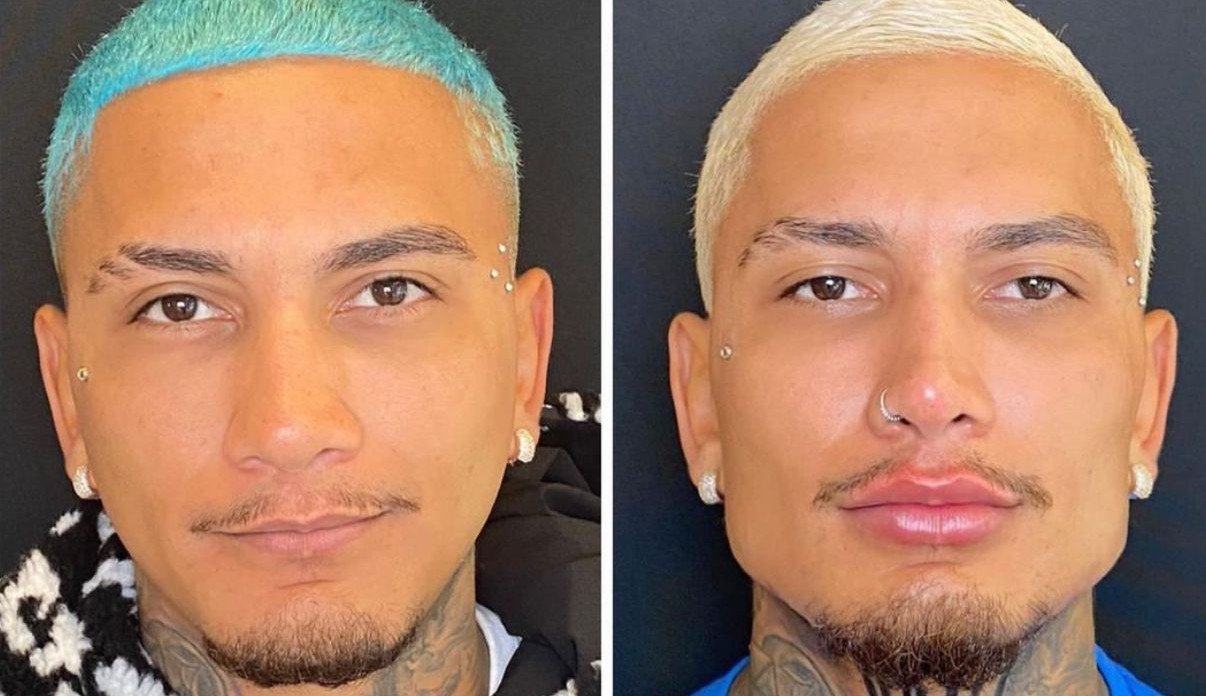 Dynho Alves faz harmonização facial e fãs especulam sua participação em “/A Fazenda 13″/