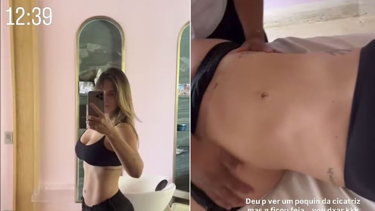 “Não ficou feia,” afirma Virginia sobre sua cicatriz da cesárea do terceiro filho