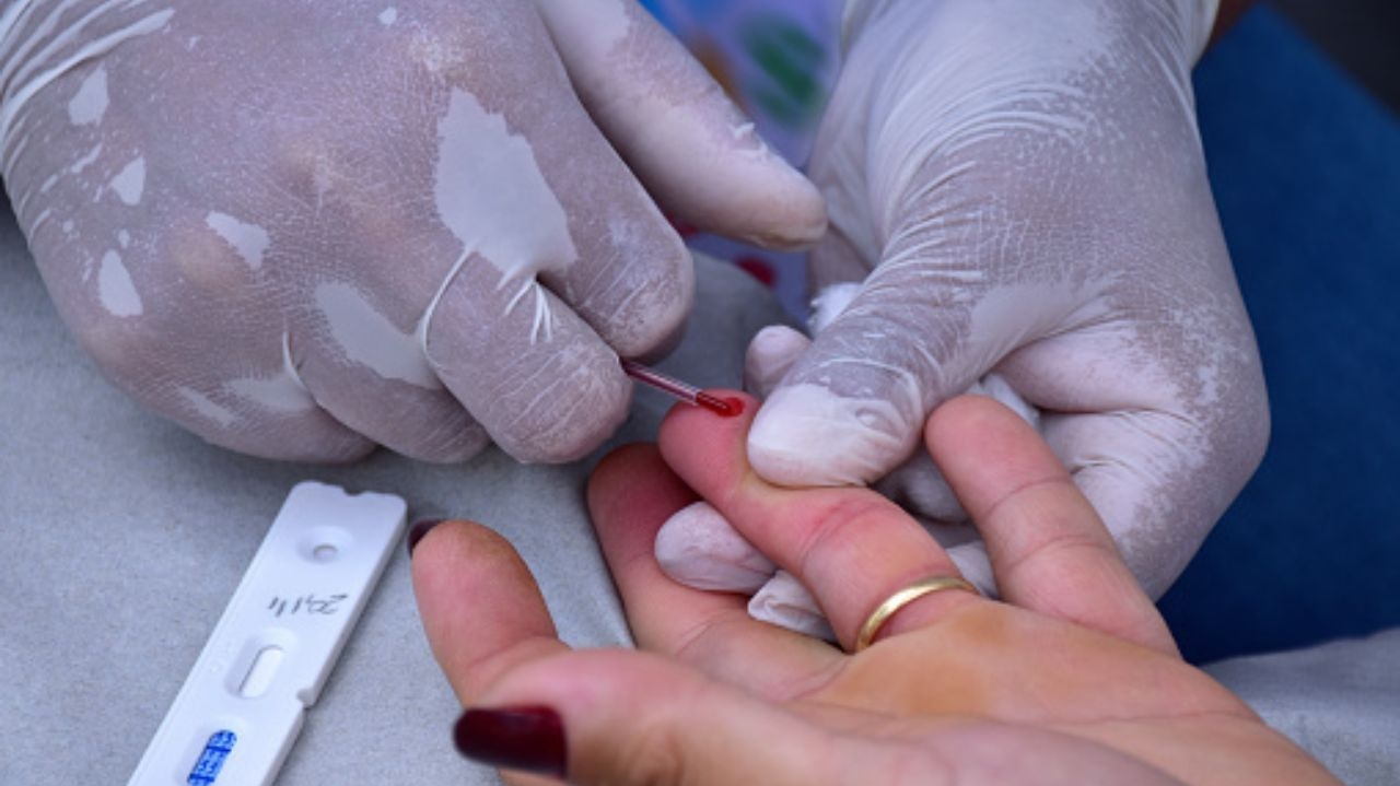 Polícia Civil conclui primeira etapa de investigação sobre erros dos testes de HIV no RJ