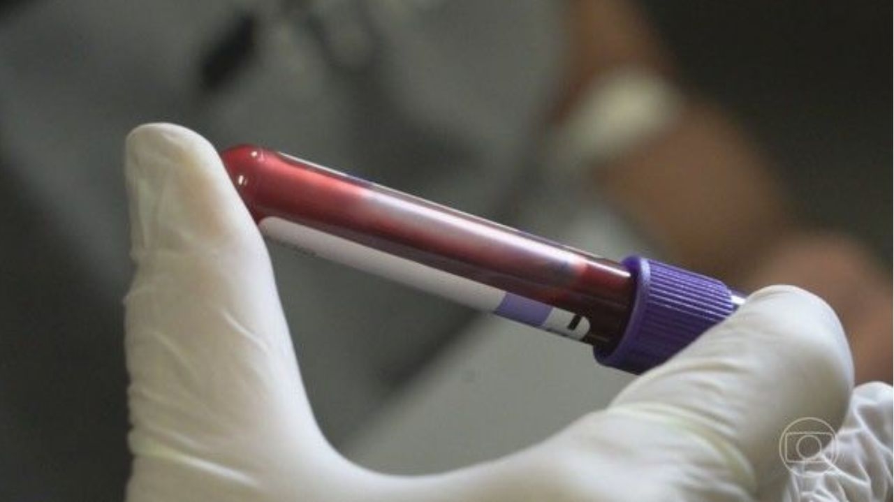 Paciente de 70 anos infectado por HIV após transplante é internado no Rio