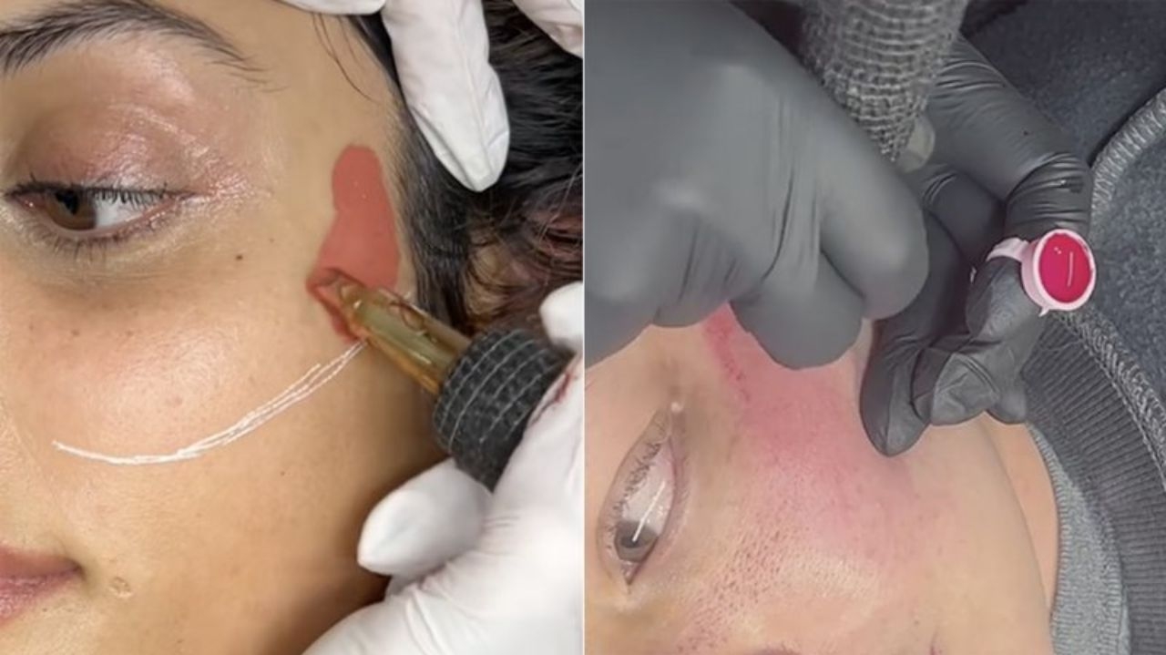Blush permanente: o que você precisa saber sobre esta nova tendência