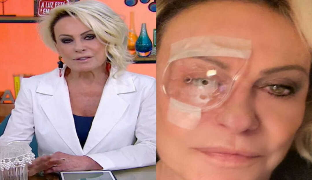 Ana Maria tranquiliza fãs ao postar foto com protetor ocular