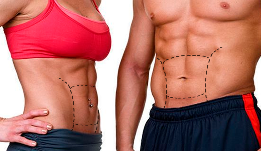 Lipo HD com Renuvion®, definição muscular e pele firme