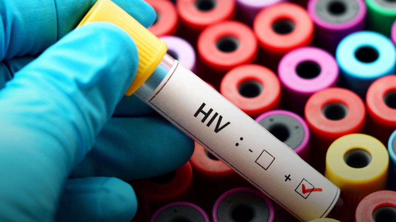 HIV: suspensão de ajuda internacional pode agravar na ocorrência de AIDS