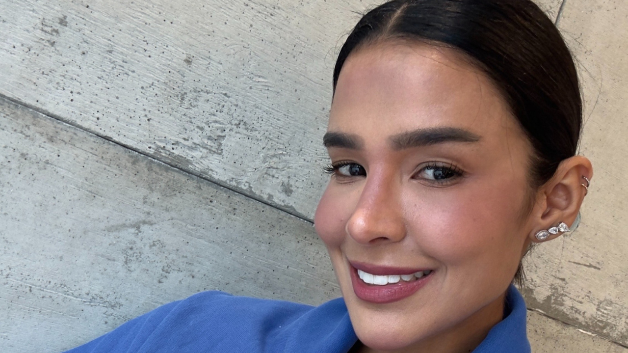 Ex-BBB Kerline reverte preenchimento labial e aposta em naturalidade: “Meu rosto rejuvenesceu”