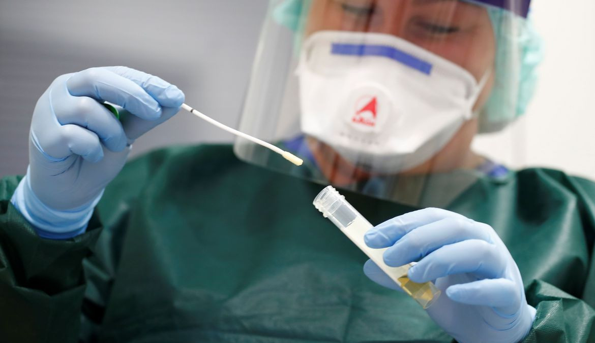 Pessoas que foram expostas ao Covid 19 e não pegaram o vírus motivam estudo