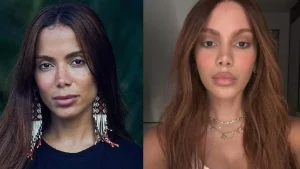 Anitta nega boatos sobre cirurgia estética e justifica afastamento das redes sociais